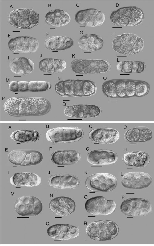 Orientation of cells at the four-cell stage in 35 species. Families and genera are, for (a) A-J, Rhabditina; A, Teratorhabditis; B, Bunonema; C, Cruznema; D, Mesorhabditis; E, Diploscapter; F, Rhabditella; G, Rhabditis; H, Caenorhabditis; I, PS1010; J, Protorhabditis. K, Aphelenchidae (Aphelenchus). L, Aphelenchoididae (Aphelenchoides). M-P, Tylenchina; M, Belonolaimidae (Belonolaimus); N, Heteroderidae (Meloidogyne); O-P, Pratylenchidae (Pratylenchus and Nacobbus). Q , Teratocephalidae (Teratocephalus). (b) A-I, Cephalobidae; A, Chiloplacus; B, Zeldia; C, Cephalobus; D, Acrobeloides; E. Acrobeles; F, Eucephalobus; G, Pseudoacrobeles; H, Nothacrobeles; I, Cervidellus. J-L, Diplogastrina; J, Diplenteron; K, Aduncospiculum; L, Pristionchus; M, Goodeyus. N-Q , Panagrolaimidae; N, Halicephalobus; O, Panagrellus; P, Panagrobelus; Q , Panagrolaimus. R, Brevibuccidae (Plectonchus). All scale bars are 20 mm. 