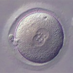 zygote